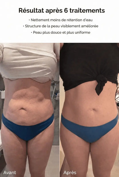 LUMIQ — Peau lisse en 14 jours