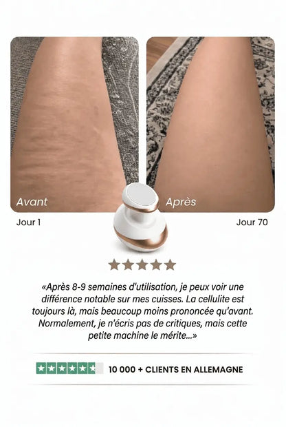 LUMIQ — Peau lisse en 14 jours
